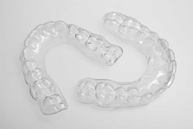 Custom NightGuard Retainer (Upper & Lower)