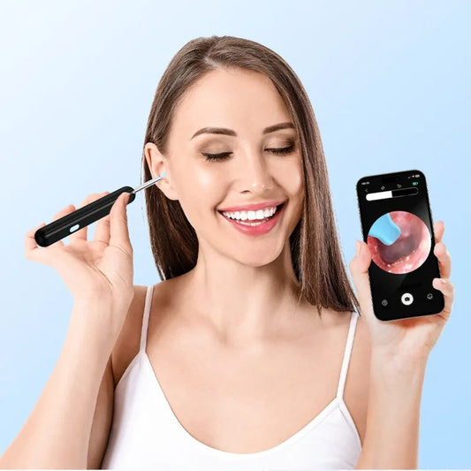 HD Ear Camera Cleaner – 1296P Precision with LED Lights & USB-C Charging